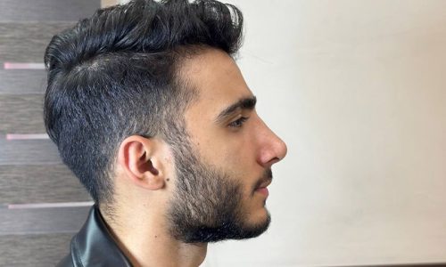 بهترین-جراح-بینی-تبریز-3