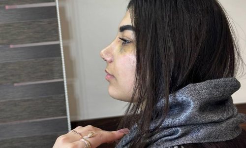 بهترین-جراح-بینی-تبریز-4